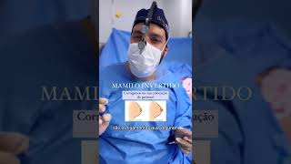 Mamilo Invertido Pode Ser Corrigido Na Sua Colocação De Prótese De Mama