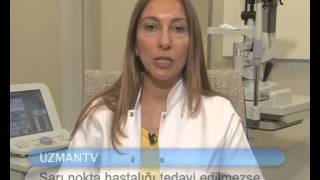 Sarı Nokta Hastalığı Tedavi Edilmezse Ne Olur Doç. Dr. Nur Acar Göz Hastaliklari Uzmani