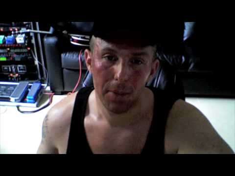 Chemical Peel. tca chemical peel. Chemical Peel.