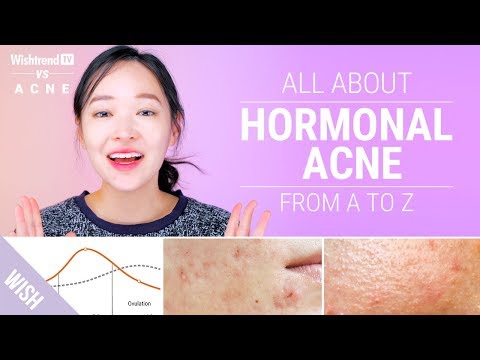 How to Cure Hormonal Acne : Lifestyle & Skincare Tips! | Wishtrend TV VS ACNE - YouTube