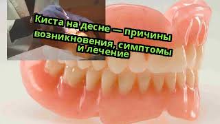 Флюс на десне при коронках Флюс на десне при коронках