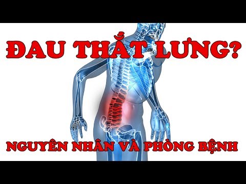 ĐAU THẮT LƯNG - NGUYÊN NHÂN VÀ CÁCH PHÒNG TRÁNH