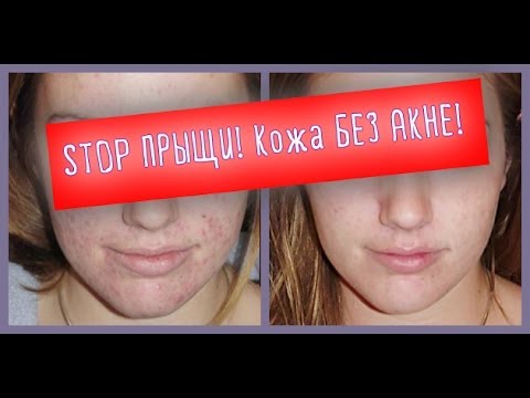 Alena April: Увлажнение с линейкой Идеальная кожа от Чистой Cached