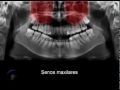 Panoramic X-rays radiografia panoramica para diagnostico dental advance clinica aimone diego