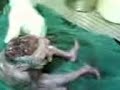 image Bayi Manusia Lahir Mirip Kodok