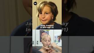 Wonder Cast Then And Now