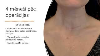 LĶA: Metastātiski endokrīnie audzēji un krūts rekonstruktīvās ķirurģijas aktualitātes