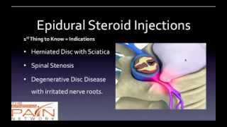 Side effects of steroid shots for pain