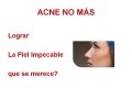 COMO QUITAR EL ACNE NATURALMENTE | Como quitar el acne naturalmente y rápido