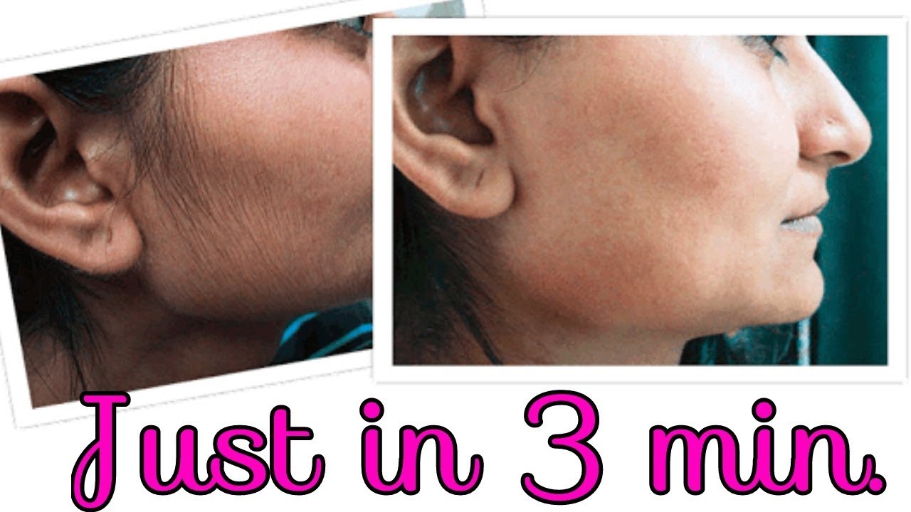 Facial hair natural removal