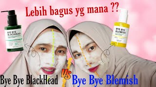 Bye Bye Blackhead Vs Bye Bye Blemish