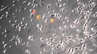 Automated apoptosis detection in phase contrast microscopy