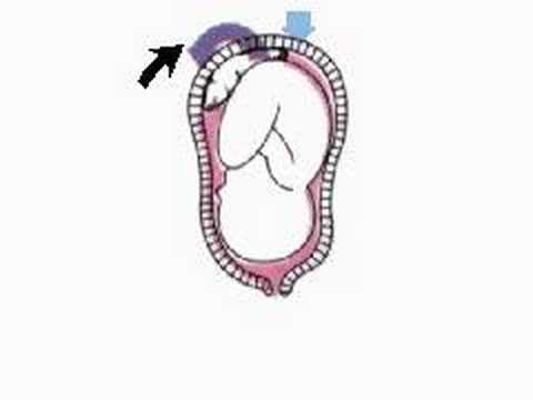 During pregnancy, progesterone makes the uterus relatively unresponsive ... During pregnancy, progesterone makes the uterus relatively unresponsive ...