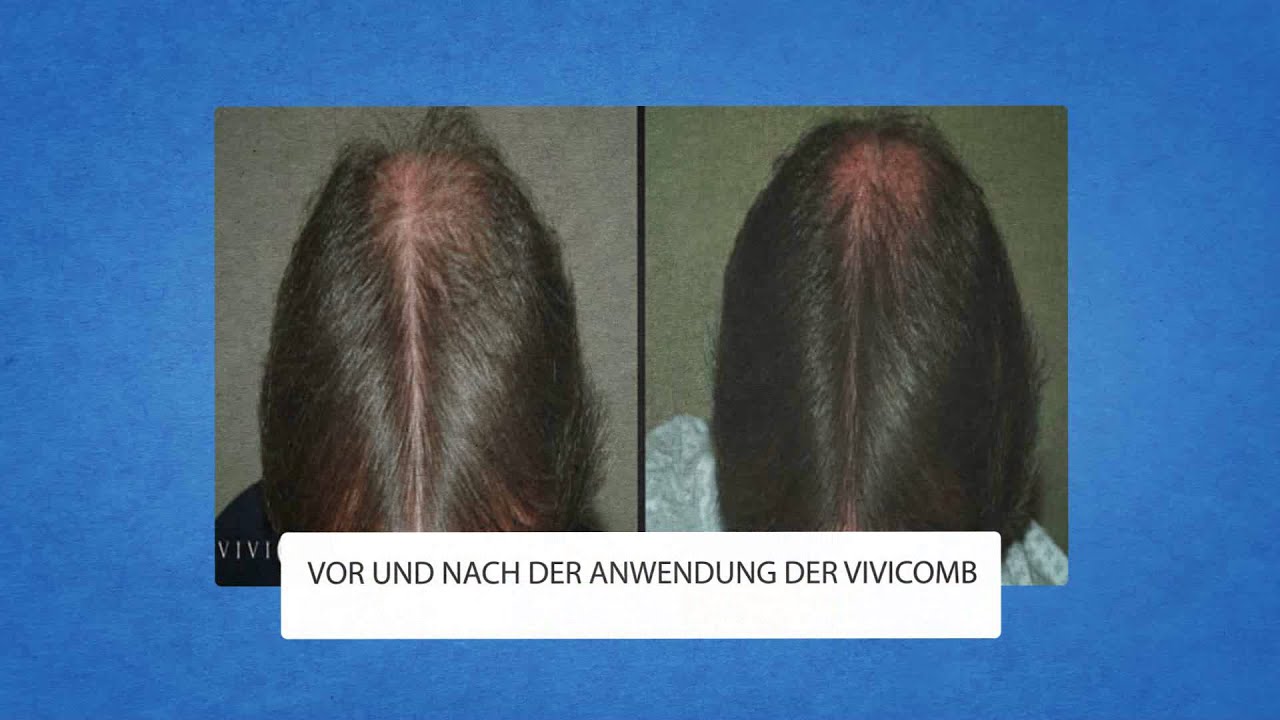 Der schwarze Pfeffer beim Haarausfall