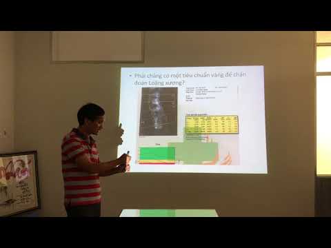 Triệu chứng loãng xương - BS Chiêu Bmt