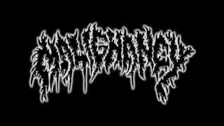 Watch Malignancy Motivated By Hunger video