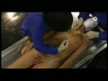 Anatomy