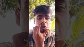 How I Cured A Bug Bite With Yogurt In The Wild Survival Hacks