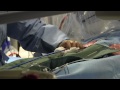 Dr. John Webb, St. Paul's Hospital Instructs Live Heart Valve Replacement