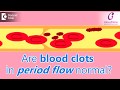 Why does menstrual bleeding have blood clots? Is it normal?-Dr.Shalini Varma of Cloudnine Hospitals