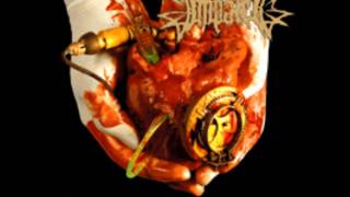 Watch Impaled Medical Waste video