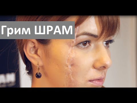 Макияж для лица с рубцами Макияж для лица с рубцами