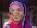 Artis Bertudung images Artis Bertudung