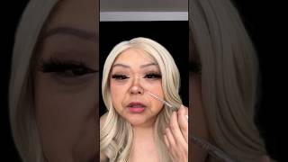Asmr Botox For Wrinkles Gone Wrong