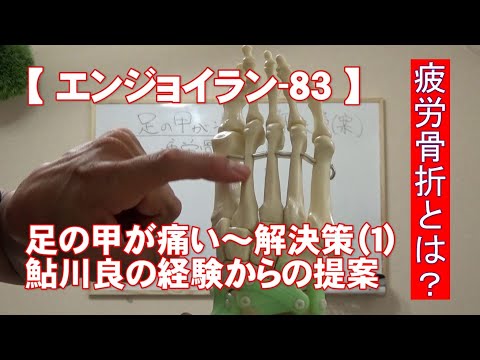 #83 足の甲が痛い 解決策 1/4/がんばらないで楽に長く走る【エンジョイラン】
