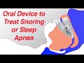 Mandibular Advancement Device (MAD) to Treat Snoring and Sleep Apnea