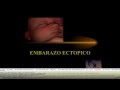 EMBARAZADA QUISTE OVARIO CASO CLINICO embarazada quiste ovario caso clinico: