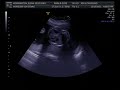 ultrasound 3d 4d