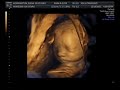 ultrasound 3d 4d
