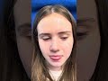 Septorhinoplasty/Endoscopic Sinus Surgery/Turbinate Surgery 7 ago and doing well