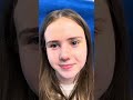 Septorhinoplasty/Endoscopic Sinus Surgery/Turbinate Surgery 7 ago and doing well