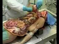 AUTOPSIA