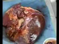 AUTOPSIA