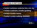 Talk To The Doc chat: Stroke