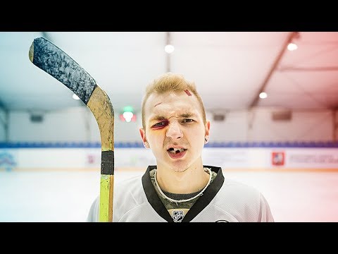 КАК РАЗБИТЬ ЛИЦО!? /ХОККЕЙ🏒 / КРОССБАР ЧЕЛЕНДЖ😱😅 КАК РАЗБИТЬ ЛИЦО!? /ХОККЕЙ🏒 / КРОССБАР ЧЕЛЕНДЖ😱😅