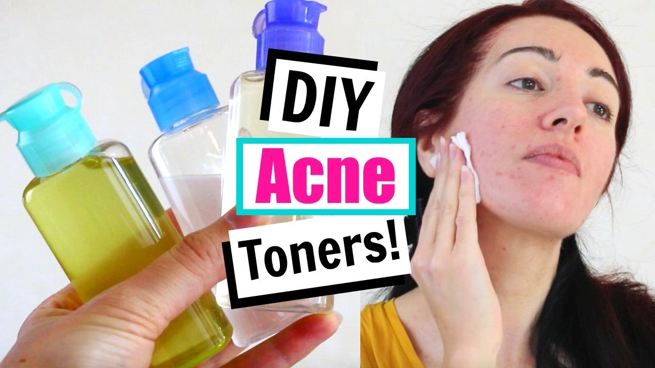 Homemade facial toner for oily skin