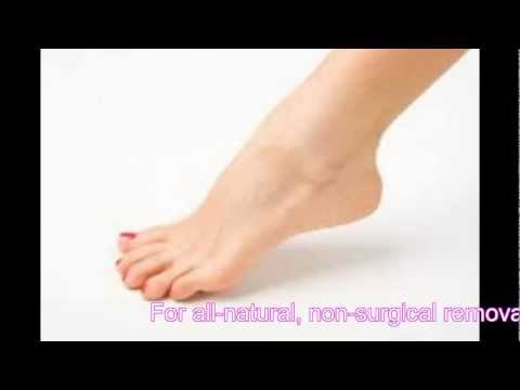 Different Foot Types