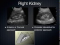9 Abdominal and Renal Ultrasound