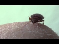 What a Bed Bug looks like feeding on you!!!