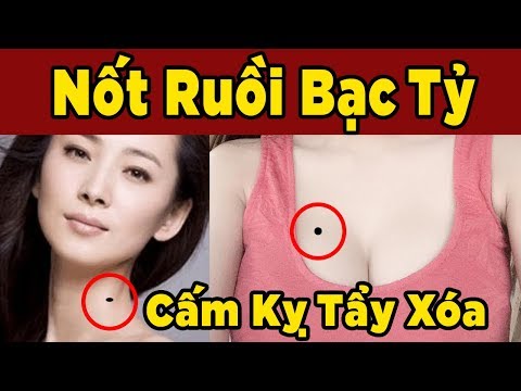 7 Nốt Ruồi Ở Cổ Và Ngực Khiến Bạn Muốn Nghèo Cũng Không Được, Nốt Ruồi Quý Bạc Tỷ CẤM KỴ TẨY XÓA