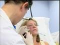 Cosmetic Makeover Breakthrough: Scupltra