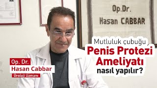 Penis Protez Ameliyatları - Op. Dr. Hasan Cabbar