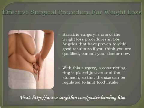 Get The Best Solution For Your Weight Loss Surgery