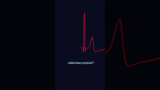 Heartscan - Zero Circle