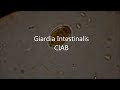 Giardia intestinalis  CIAB  www.ciab.es