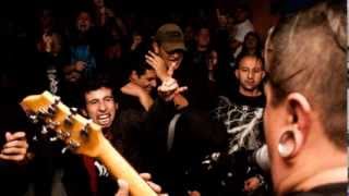 Watch Haemorrhage Obnoxious surgeon Of The Dead video